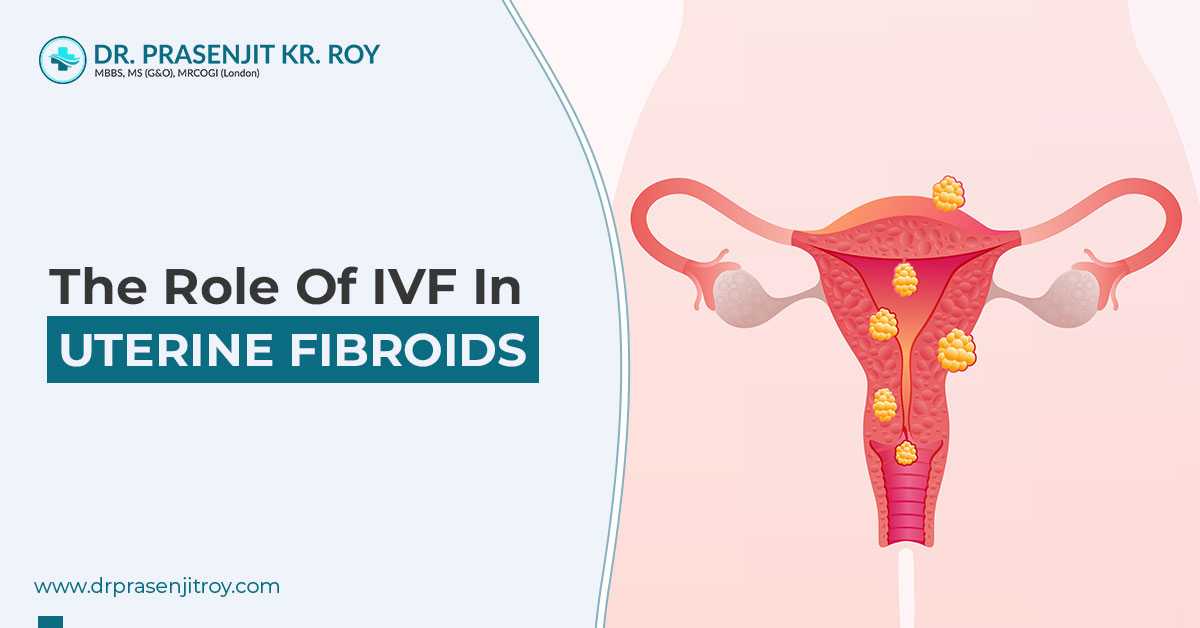 Uterine Fibroids – Does IVF Treatment Help?