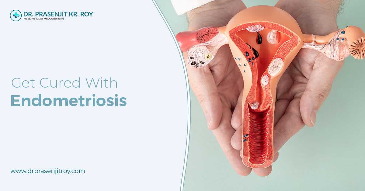 Get Cure With Endometriosis