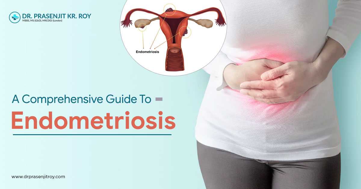 Endometriosis – Visit Your Best IVF Doctor To Get Relief