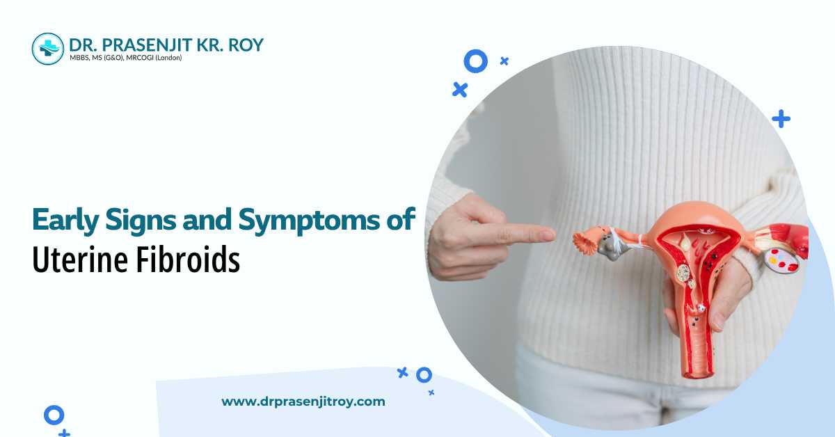 Early Signs & Symptoms of Uterine Fibroids