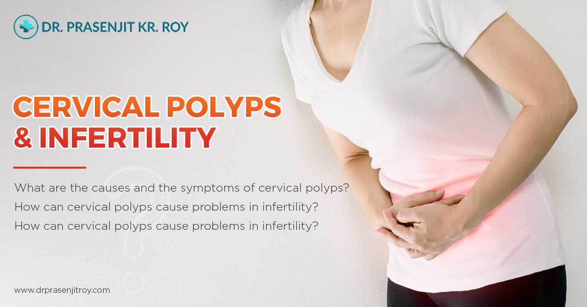 Cervical Polyps and Infertility