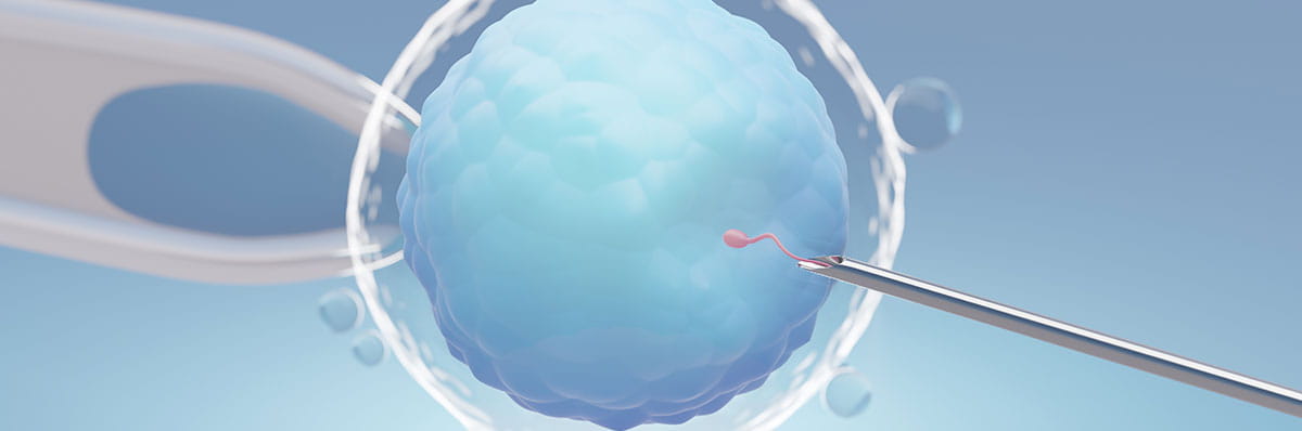 Intracytoplasmic Sperm Injection